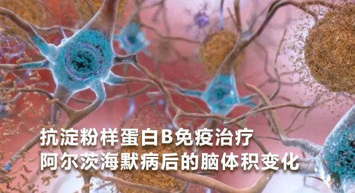 抗淀粉样蛋白&beta;免疫治疗阿尔茨海默病后的脑体积变化(中文版)
