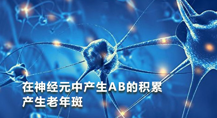 在神经元中产生AB的积累产生老年斑(中文版)