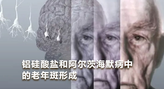 铝硅酸盐和阿尔茨海默病中的老年斑形成(中文版)
